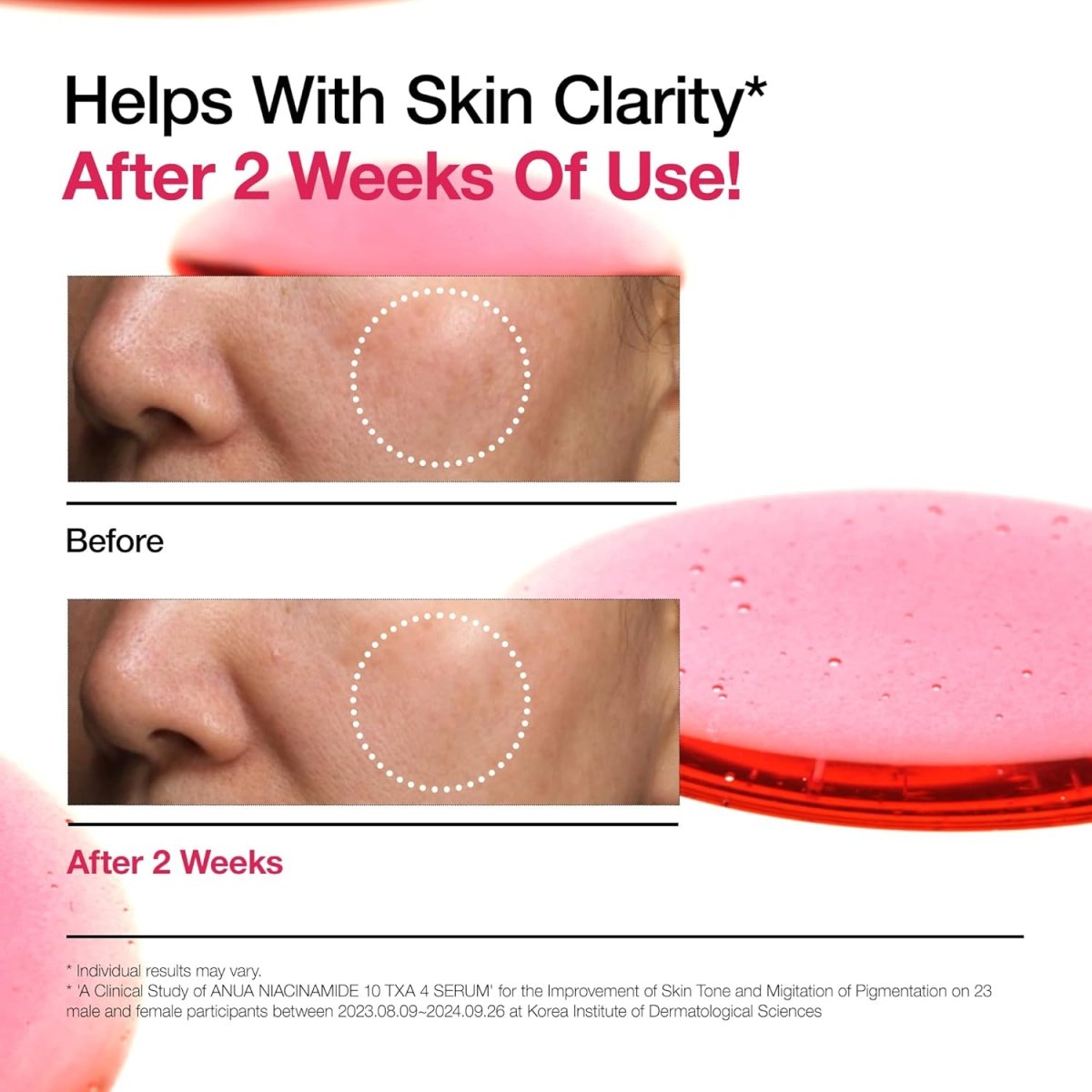 ANUA 10%煙酰胺+ 4% 氨甲環酸精華 30ml - Beautitu.com