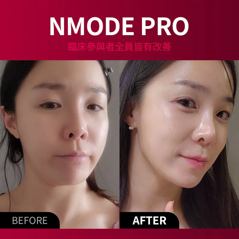 beaund NMODE PRO 高端居家V臉面部美容儀 一年保養 - Beautitu.com