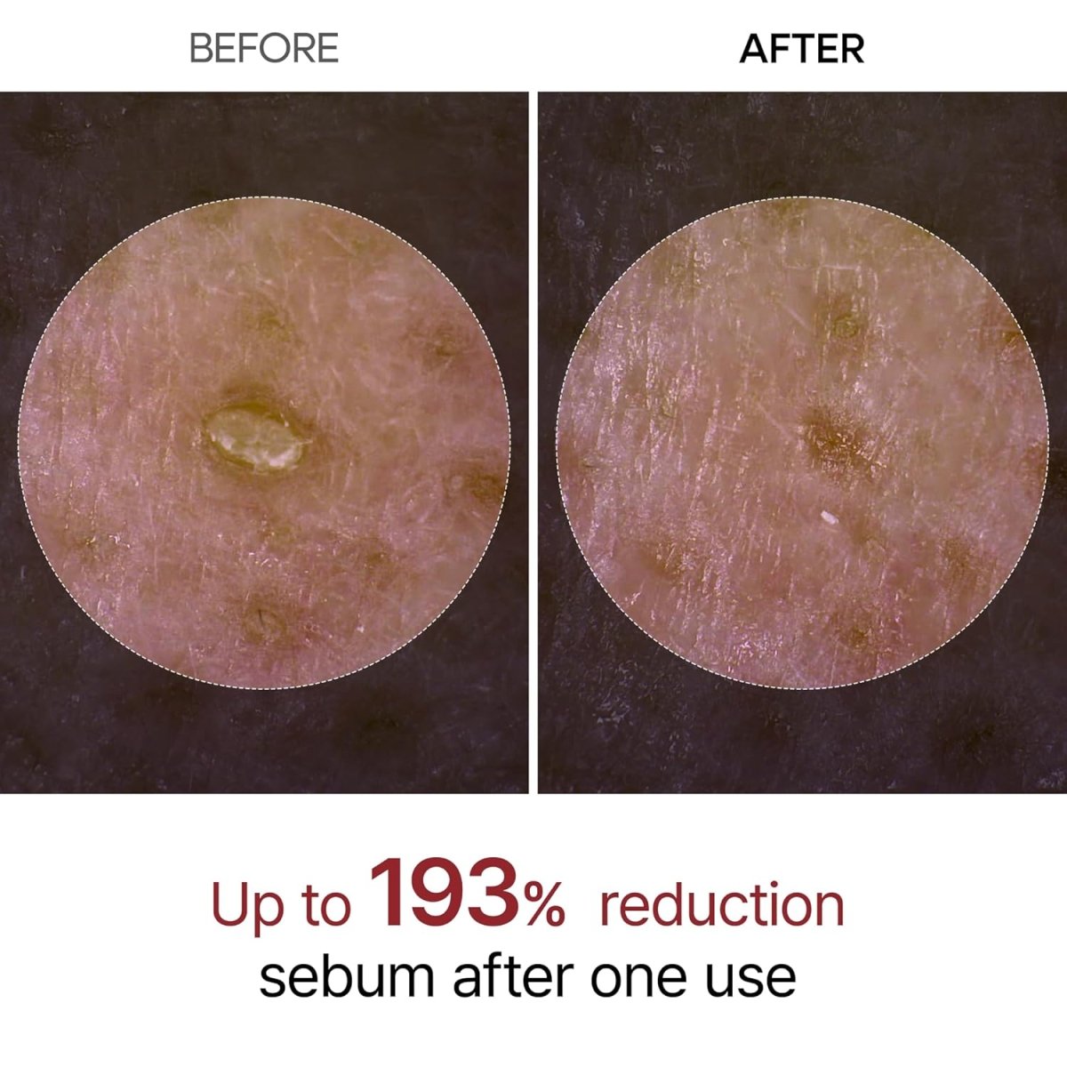 Dr.Melaxin Peel Shot 黑米去角質柔膚精華 80ml - Beautitu.com