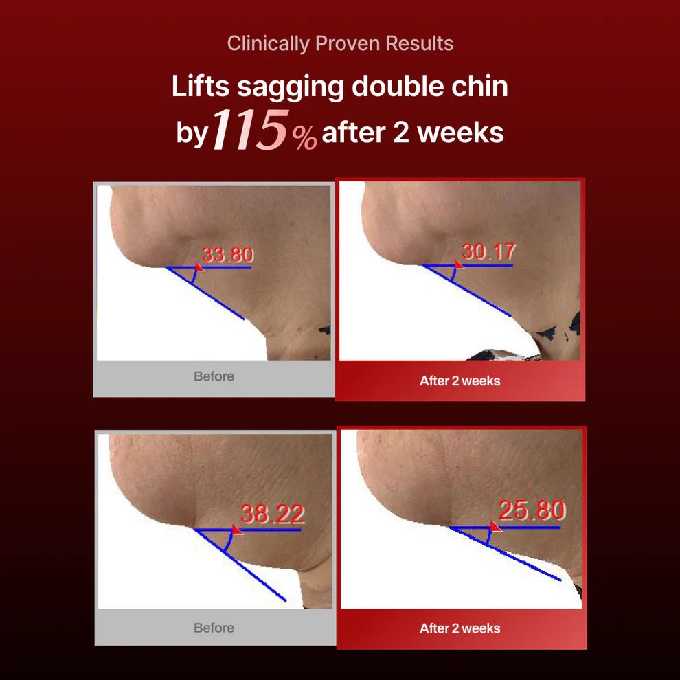 MEDITHERAPY 緊緻修復頸膜(1盒7片) - Beautitu.com