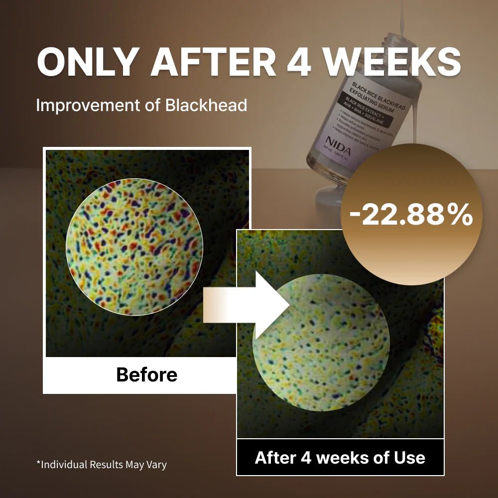 NIDA 黑米黑頭去角質精華液 50ml - Beautitu.com