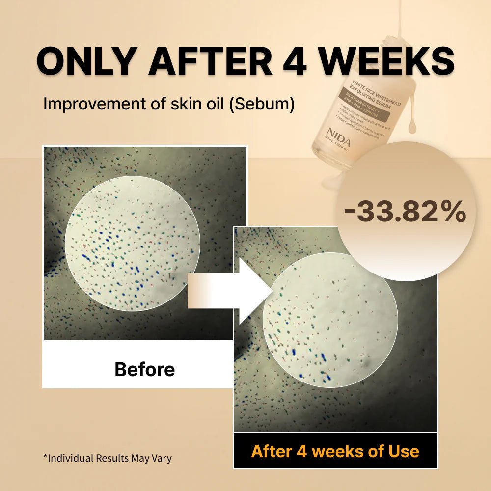 NIDA 白米白頭去角質精華液50ml - Beautitu.com