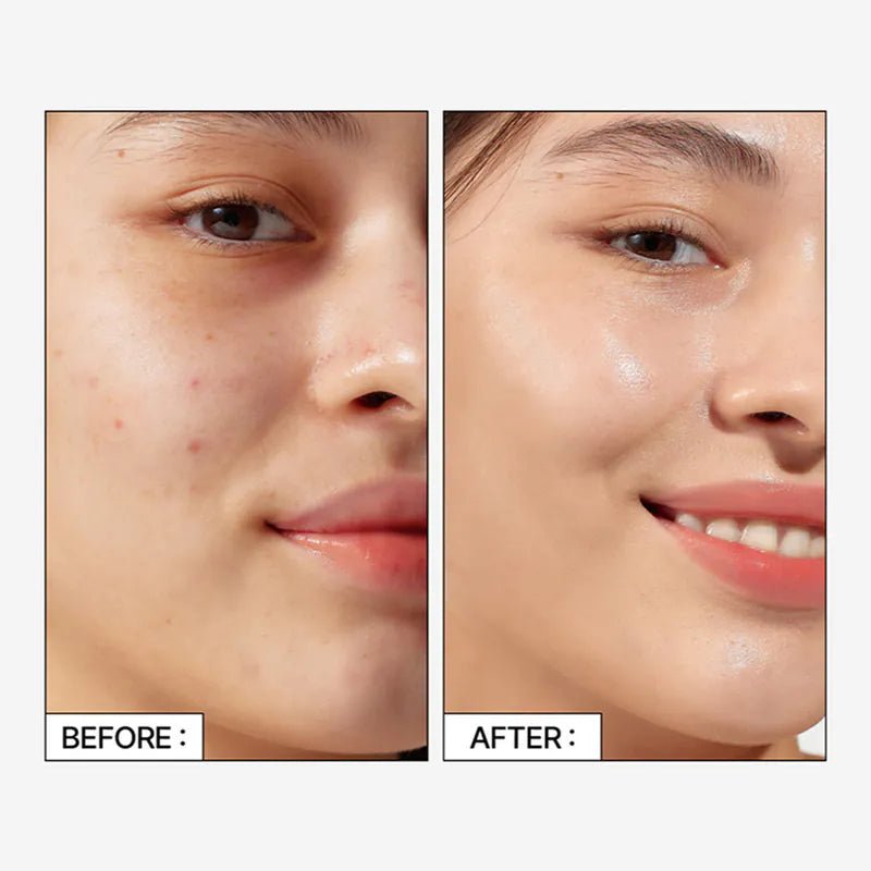 Parnell 積雪草精粹92精華【晚間修護】30ml - Beautitu.com