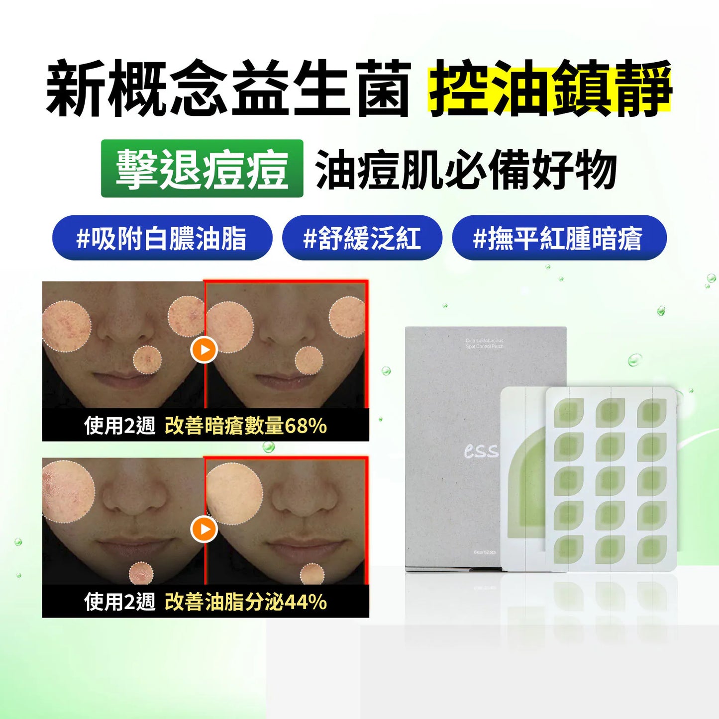essl 積雪草控油鎮靜暗瘡貼 62片裝