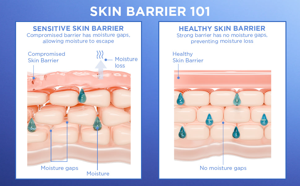 skin barrier 101