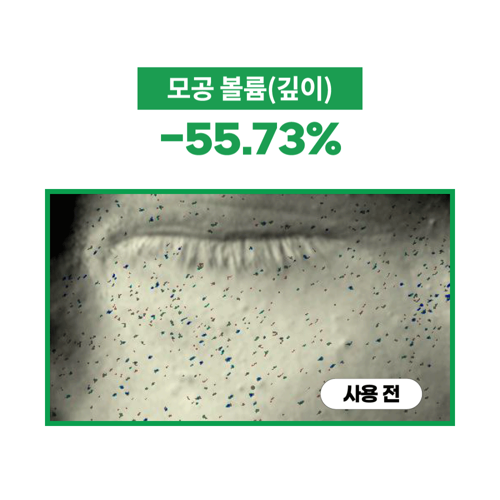 韓國熱賣No.1面霜~S.NATURE Aqua Squalane Moisturizing Cream 角鯊烷保濕面霜 - 大容量80ml