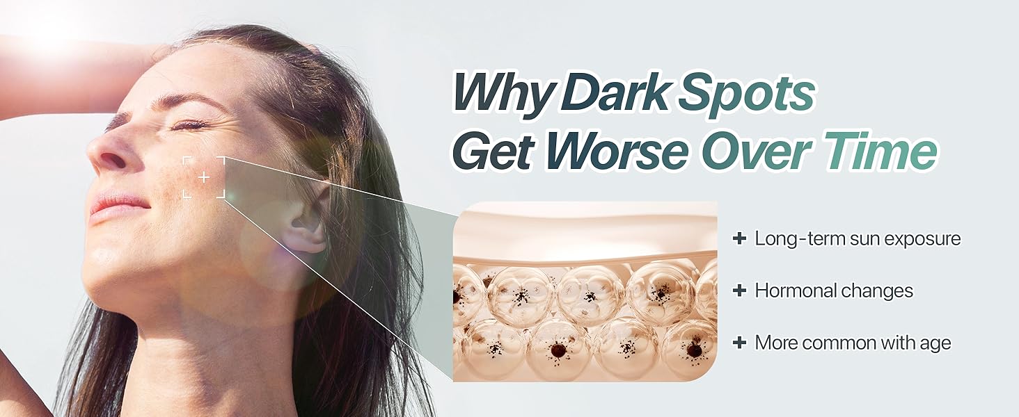 Shows why dark spots become more noticeable over time and the importance of early care.