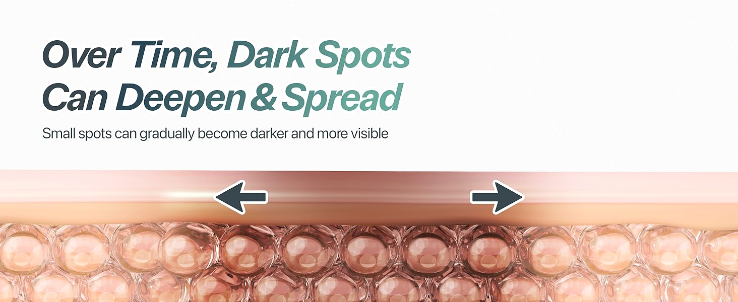 Illustration showing how dark spots can gradually deepen and spread when left unmanaged over time