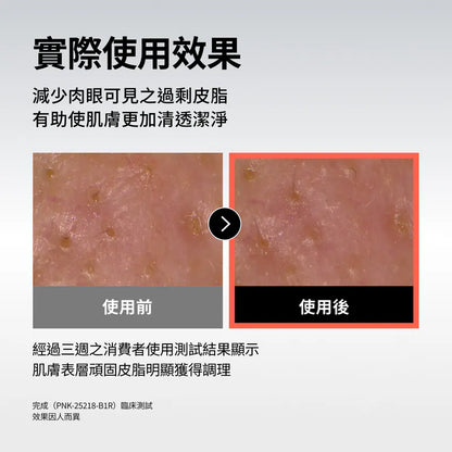 Celladix 131 高濃縮消去痘安瓶 30ml