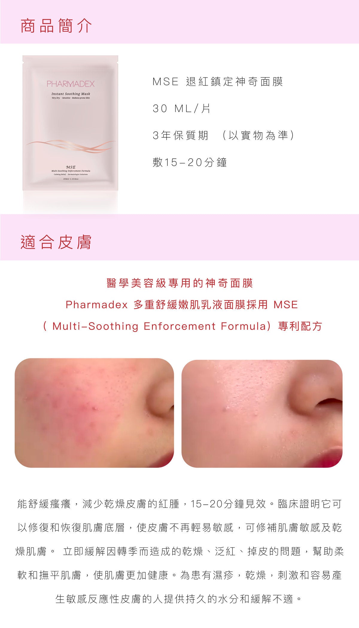 Pharmdex MSE Instant Soothing Mask