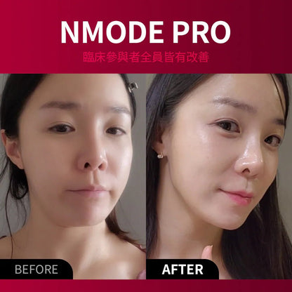 beaund NMODE PRO 高端居家V臉面部美容儀 一年保養 - Beautitu.com