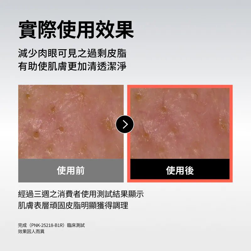 Celladix 131 高濃縮消去痘安瓶 30ml - Beautitu.com