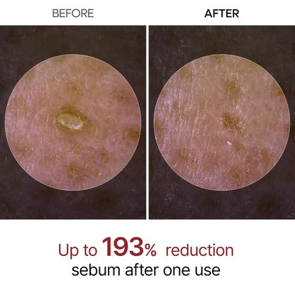 Dr.Melaxin Peel Shot 黑米去角質柔膚精華 80ml - Beautitu.com