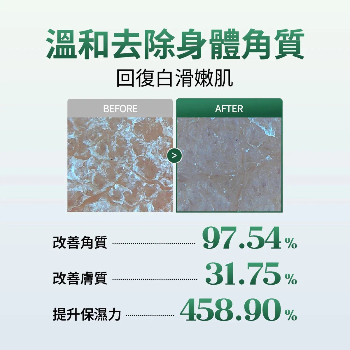 essl 魚腥草煥膚身體保濕去角質啫喱 100ml - Beautitu.com