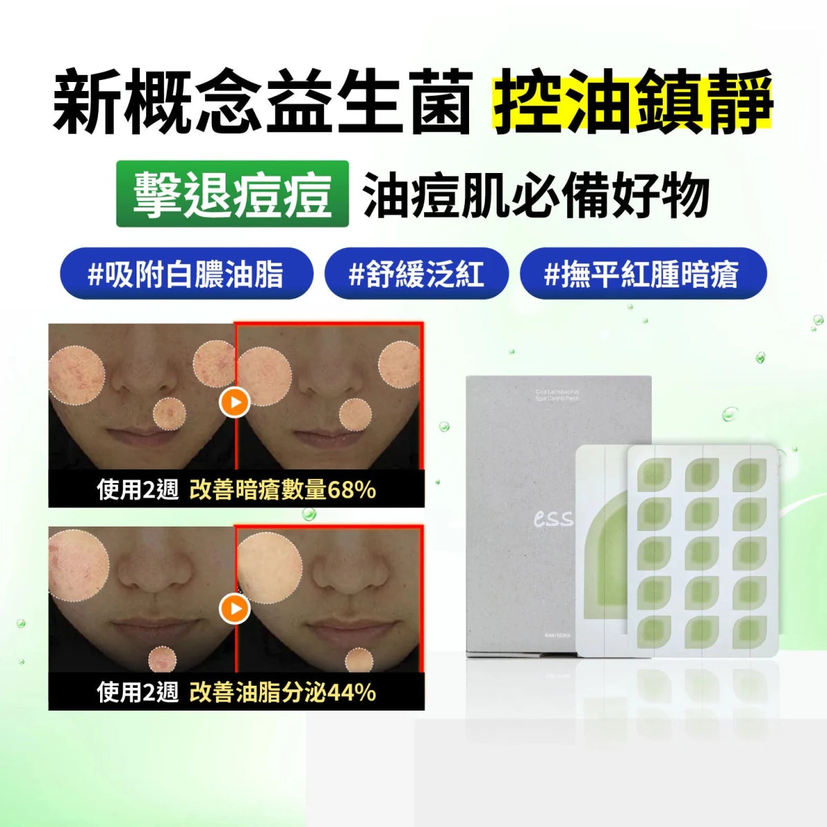 essl 積雪草控油鎮靜暗瘡貼 62片裝 - Beautitu.com