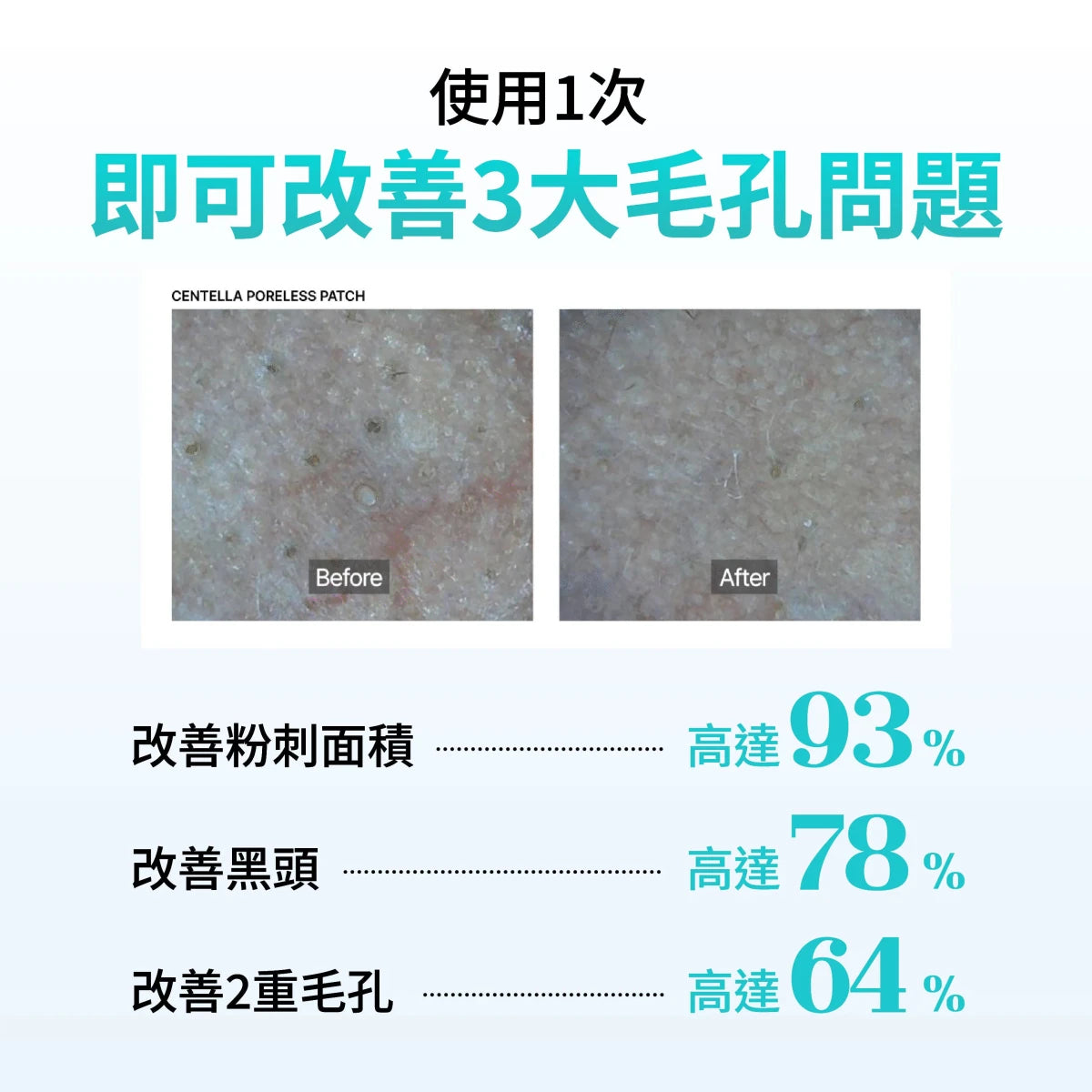 essl 積雪草控油緊緻鼻膜 8片 - Beautitu.com
