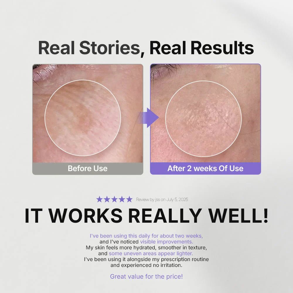 Genabelle Melacare 密集修護霜 50ml - Beautitu.com