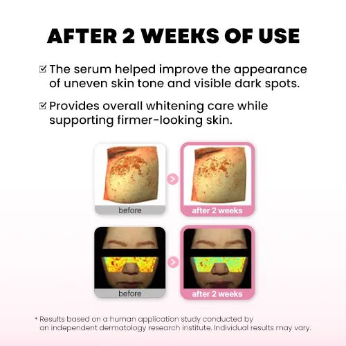 Hanmi Pro-Calm Mela 提拉 褪黑祛斑美白精華液 20ml - Beautitu.com