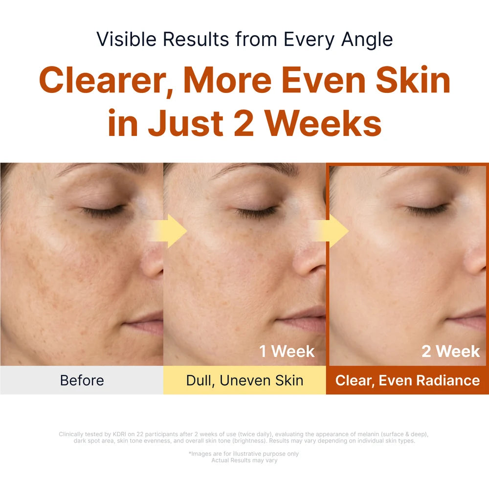 SUNGBOON EDITOR KOJIC ACID NIACINAMIDE 亮白精華 40ML