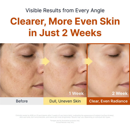 SUNGBOON EDITOR KOJIC ACID NIACINAMIDE 亮白精華 40ML
