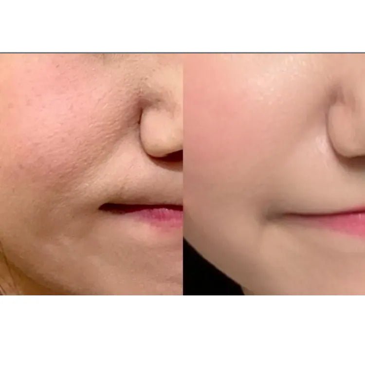 Meditherapy 維他命C泡泡提亮精華 100ml - Beautitu.com