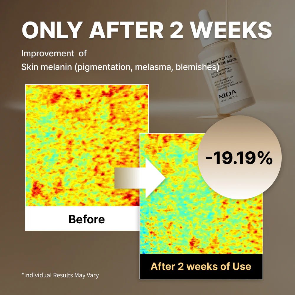 NIDA α - 熊果素強效亮白精華液 50ml - Beautitu.com
