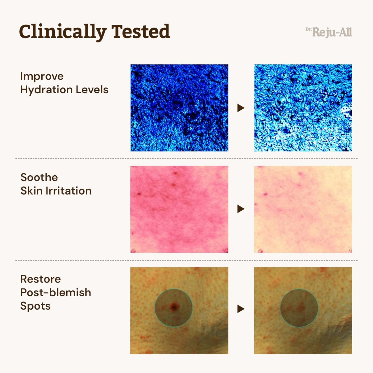 最新Version Dr. Reju - All 醫美級麗珠蘭成份高濃度PDRN再生修復霜 20g - Beautitu.com