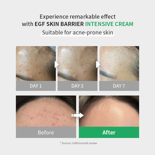 EGF Skin Barrier Intensive Cream 80ml - Affordable & trendy K